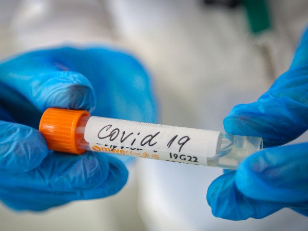 Първи случай на южноафриканския вариант на новия коронавирус е потвърден