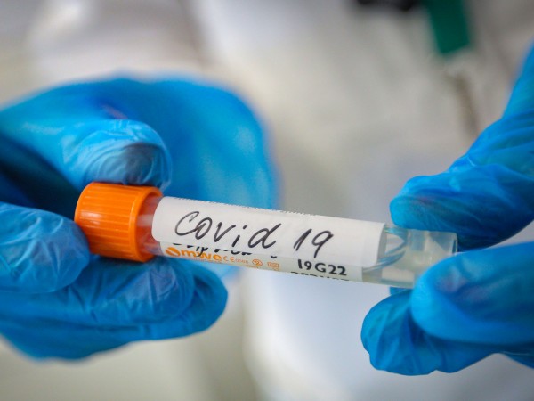 10 пациенти с коронавирус са починали за изминалите три дни