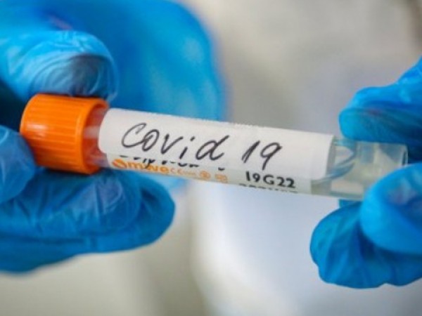 Експертен доклад: COVID-19 вероятно е скочил на хора от прилепи