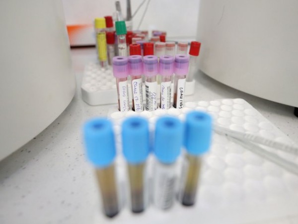 Във Великобритания всекидневни бързи тестове за коронавирус може да се