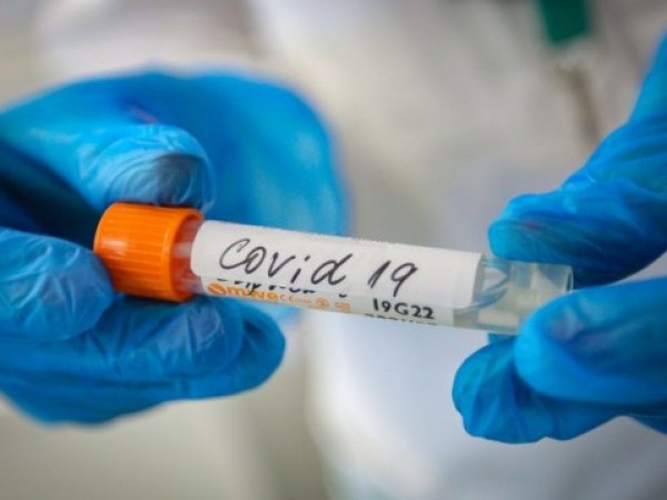 877 са новите случаи на коронавирус, установени у нас през