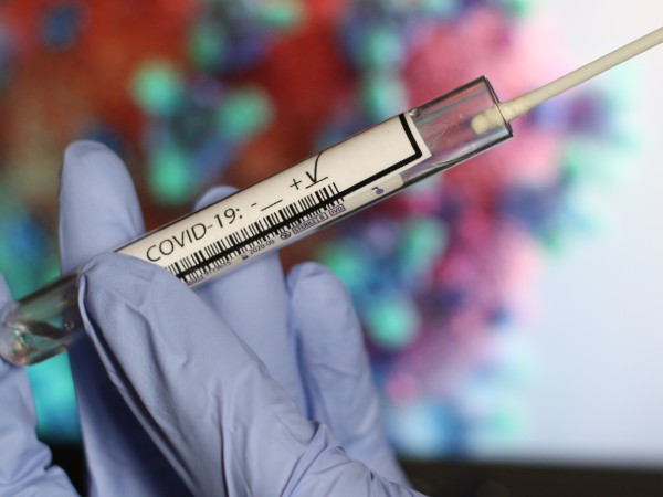 Рискът от заразяване с коронавирус е по-нисък при хората с