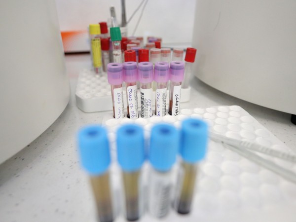 Нови 57 случая на починали с коронавирус са регистрирани през
