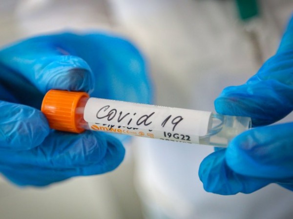 COVID-19 може да изостри стари болести и да отключи нови,