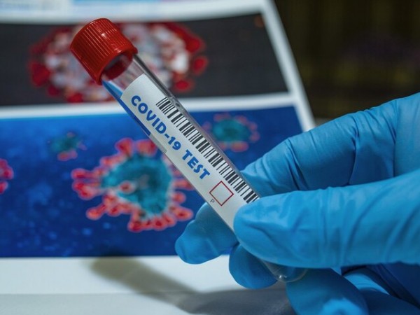По-строги мерки срещу разпространението на коронавируса въвеждат в област Монтана.