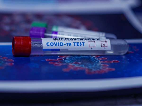 4734 са новите случаи на коронавирус у нас. Те са