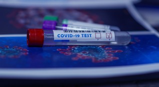 4734 са новите случаи на коронавирус у нас Те са