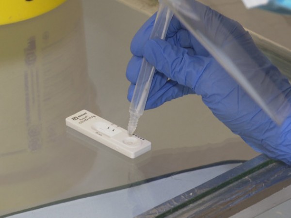 Лабораториите не разполагат с достатъчен брой тестове за антитела с