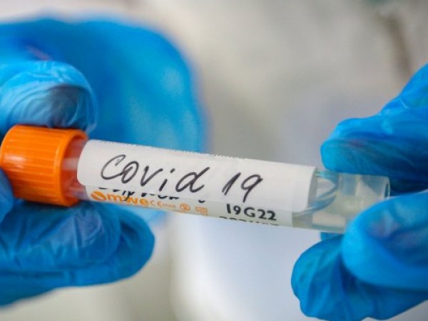 Словения потвърди 3666 нови случаи на коронавирус и 19 свързани