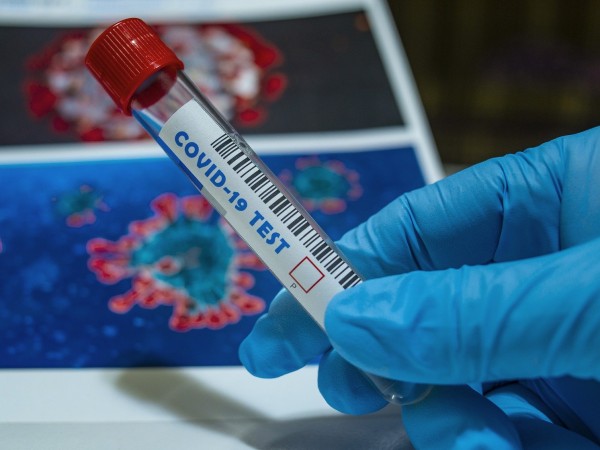 Около 120 души са се заразили с коронавирус на коледно