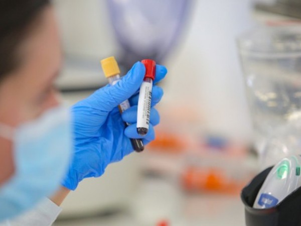 532 са новите случаи на коронавирус в страната при направени