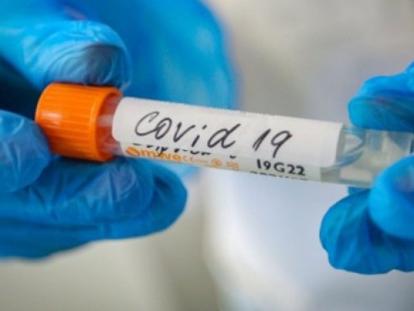 Смърт от COVID-19 може да настъпи три седмици след заразяването,