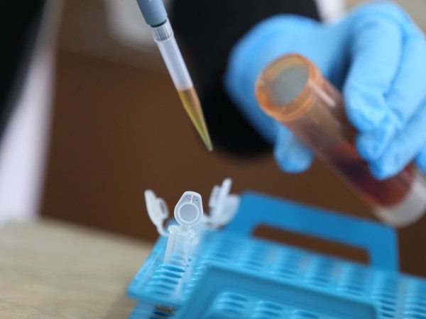 80 от изработените PCR тестове за COVID 19 с дали положителен