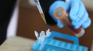 80 от изработените PCR тестове за COVID 19 с дали положителен