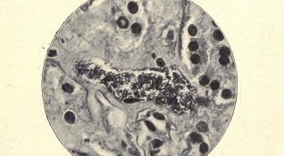 Пандемията от бубонна чума от 14 ти век може да