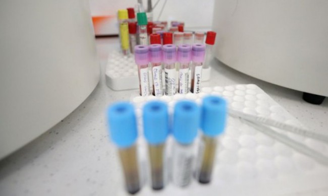 3411 са новите случаи на коронавирус, 15,5% от направените тестове