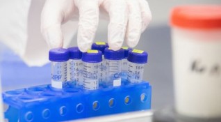 497 са новите случаи с коронавирус в страната за последното