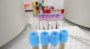 362 са новите случаи на коронавирус за изминалото денонощие при