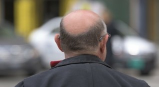 Загубата на коса е много по разпространена сред мъжете отколкото сред