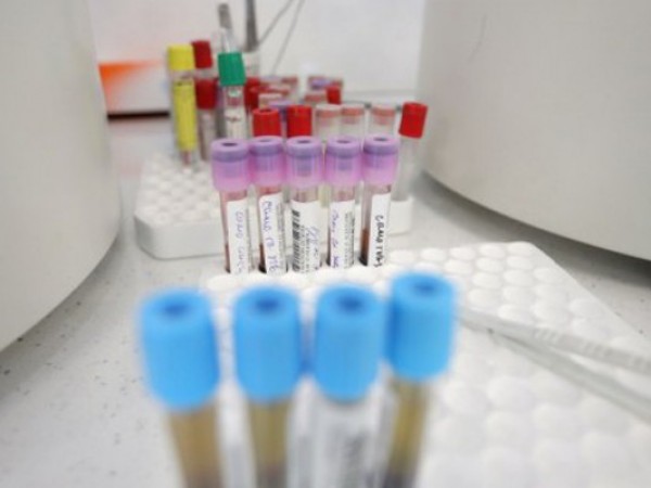 168 са новитe случаи на коронавирус в България, показват актуализираните