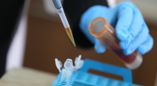 246 са новите случаи на коронавирус според данните на Единния