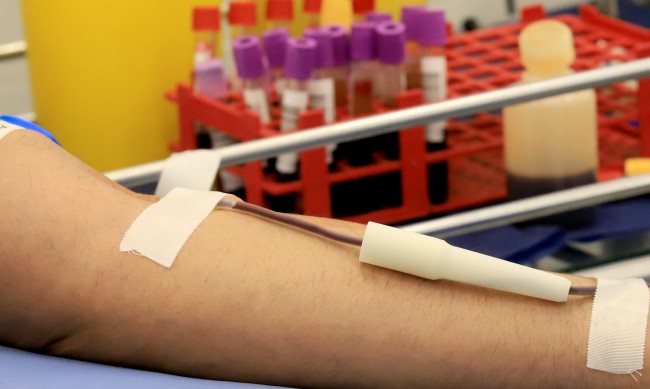 Безплатни тестове за хепатит С в столични болници 