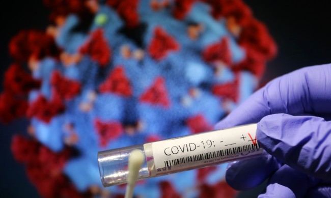 866 нови случаи на коронавирус у нас за денонощието
