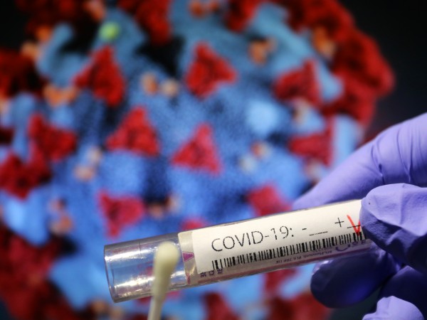 Снимка: 866 нови случаи на коронавирус у нас за денонощието