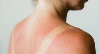 Слънцезащитен крем е продуктът който задължително да присъства в плажната