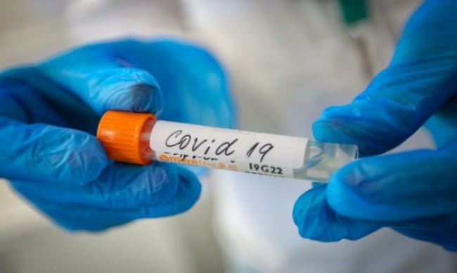 752 нови случая на коронавирус, трима души са починали