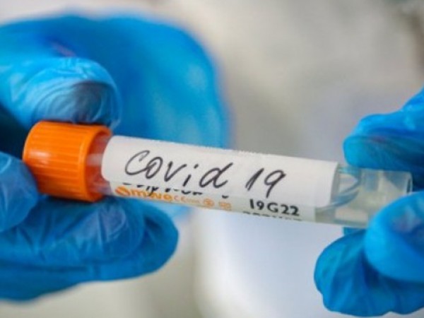 При 80% oт преболедувалите COVID-19 дълго време след инфекцията се