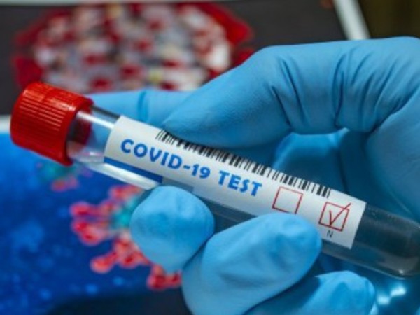 Броят на новите случаи на коронавирус по света на седмична