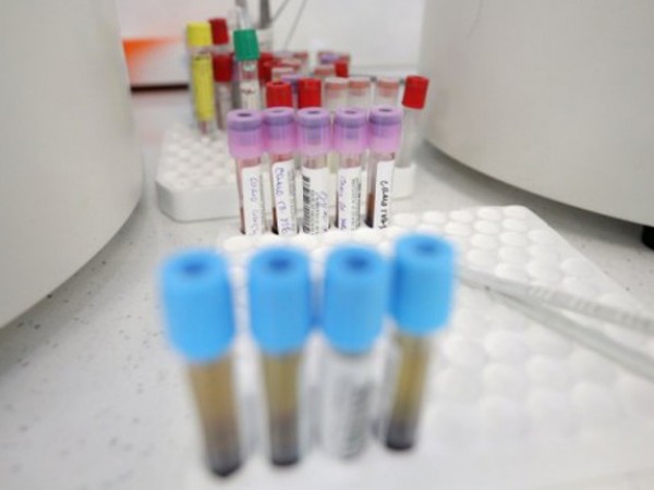 252 са новите случаи на коронавирус в България, според данните