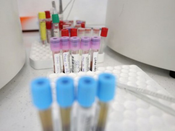343 са новите случаи на коронавирус у нас за последното