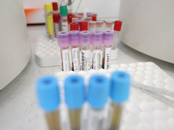 Снимка: 230 са новите случаи на коронавирус, петима са починали