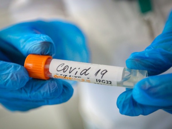 Снимка: Два случая на заразени с грип и COVID-19