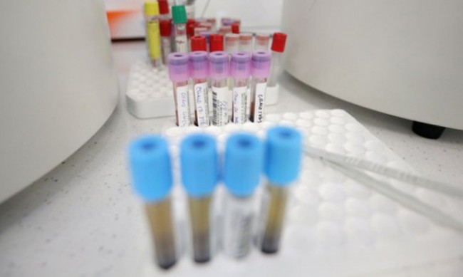 47 за новите случаи на коронавирус, трима са починали
