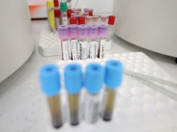 Снимка: 47 за новите случаи на коронавирус, трима са починали