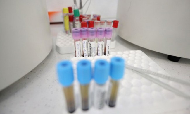 Петима починали и 262 нови случаи на коронавирус за денонощието