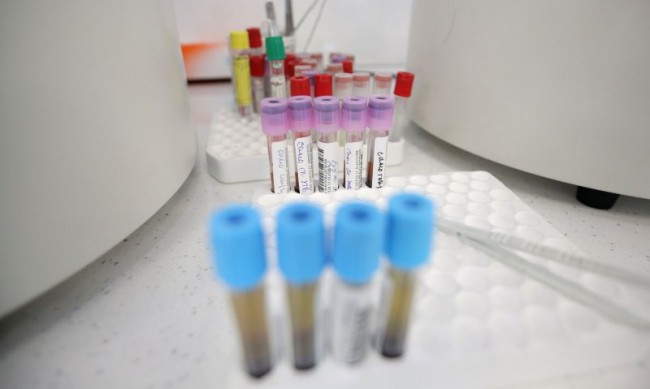 Четири нови случая на коронавирус за последните 24 часа