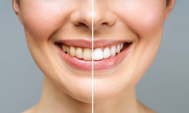 Три грижи за по-бели зъби